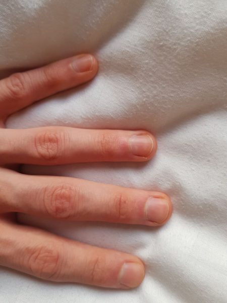Diatomaceous Earth helps nail health